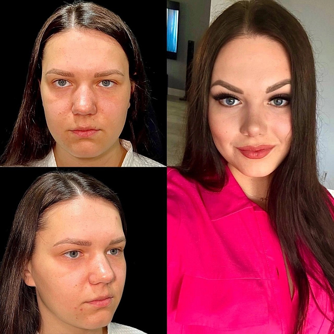 29